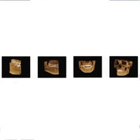 Suni Pan Q3D CBCT 3D Imaging System 400-1419 Panoramic suni-pan-q3d-cbct-3d-imaging-system-400-1419-dentamed-usa DENTAMED USA Suni Pan Q3D