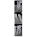 Owandy-RX Intraoral X-ray system 9459100105/9459100115 Intraoral X ray owandy-rx-intraoral-x-ray-system-9459100105 Dentamed USA Owandy-RX 