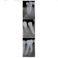 Owandy-RX Intraoral X-ray system 9459100105/9459100115 Intraoral X ray owandy-rx-intraoral-x-ray-system-9459100105 Dentamed USA Owandy-RX 