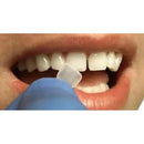 ProVeneer In-Office Veneer System – Silmet Dental 2198239 - DENTAMED USA